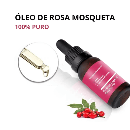 Óleo Vegetal de Rosa Mosqueta 100% Puro